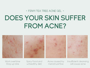 20g Moisturizing Skin Care Products - Zambeel