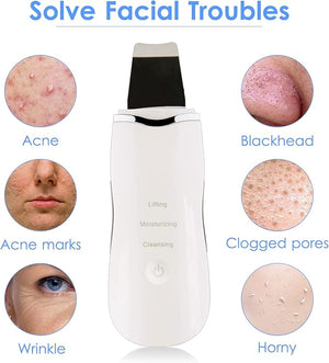 3 - in - 1 Ultrasonic Facial Skin Scrubber - Zambeel