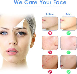 3 - in - 1 Ultrasonic Facial Skin Scrubber - Zambeel