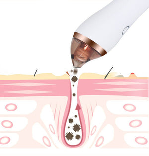 4 in 1 Body Guasha Cupping Blackhead Remover Machine Facial Pore Deep Cleansing Beauty Skin Care - Zambeel