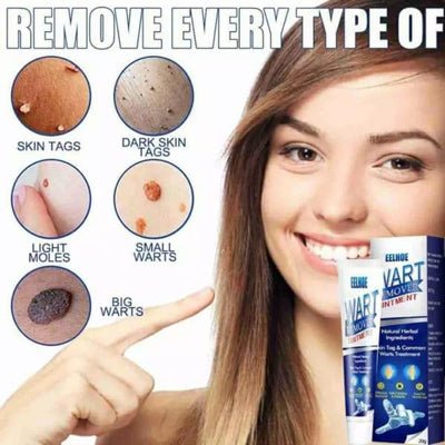EELHOE - Wart Remover Ointment