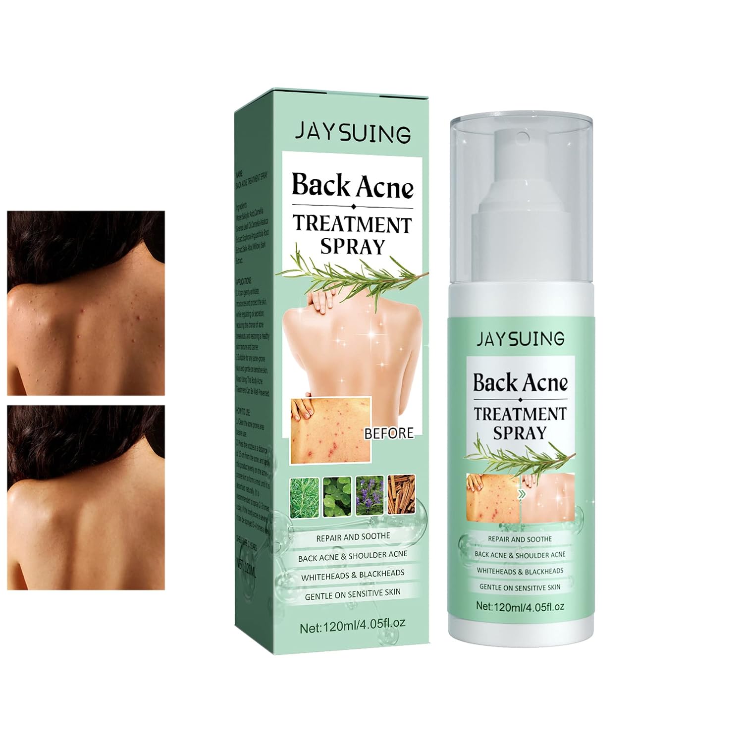 Back Acne Treatment Spray-1.jpg