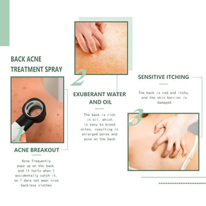 Back Acne Treatment Spray-7.jpg