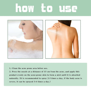 Back Acne Treatment Spray-8.jpg