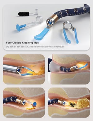 Bebird Smart Ear Cleaner-10.jpg