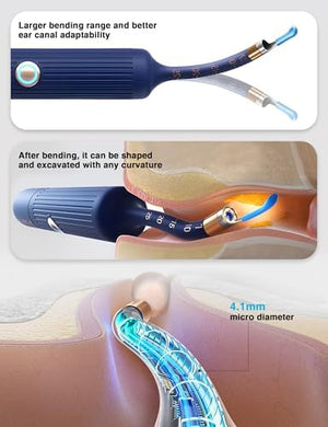 Bebird Smart Ear Cleaner-11.jpg