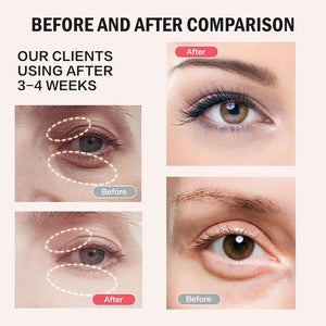 Retinol Eye Stick Balm