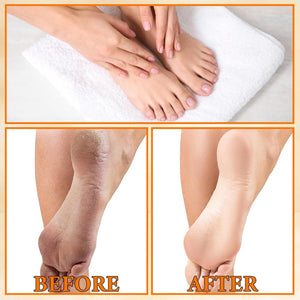 Eelhoe Foot Peeling Spray-3.jpg