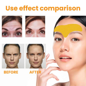 Forehead Wrinkle Patches-4.jpg