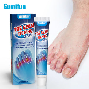 Sumifun - Toe Seam Itching Cream