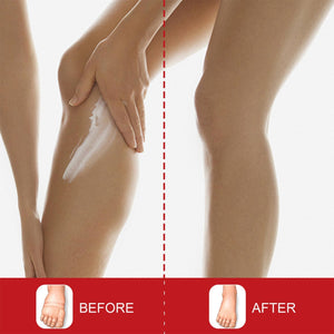 Leg Edema Relief Cream-6.jpg