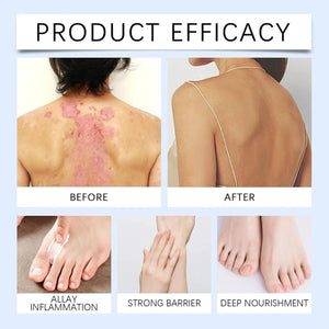 Sugarguard Foot Recovery Cream-5.jpg