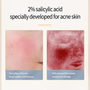 Acne Removing Salicylate Products - Zambeel