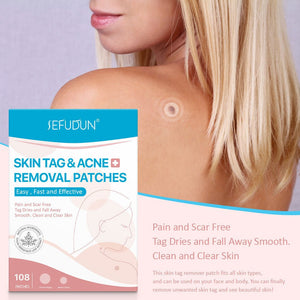 Acne Skin Tag Remover Beauty Acne Patch Wart Removal Stickers Removal Care Invisible Blackhead Skin Patch - Zambeel
