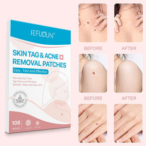 Acne Skin Tag Remover Beauty Acne Patch Wart Removal Stickers Removal Care Invisible Blackhead Skin Patch - Zambeel