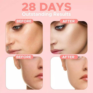 Advence Skin Care 4 In 1 FACIAL SERUM - Zambeel