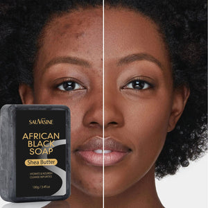 African Black Soap Deep Cleansing Body Anti - Mite Moisturizing - Zambeel
