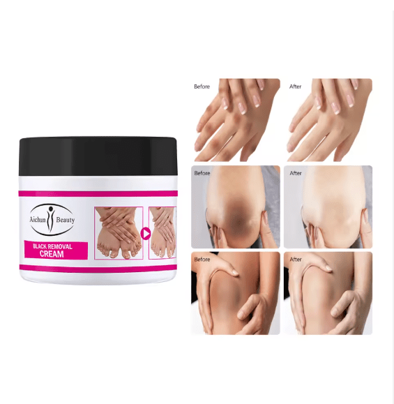 Aichun Beauty - Black Removal Whitening Cream (Original) - Zambeel