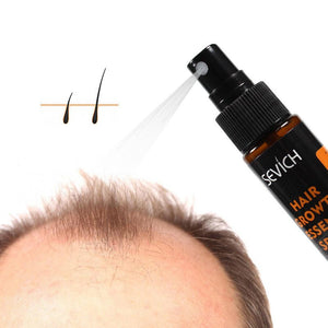 Anti - Drop Hair Lotion Tight Hair Lotion - Zambeel