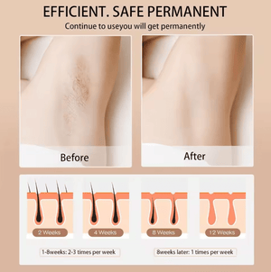 Babyverse - Digital IPL Hair Removal Device © - Zambeel