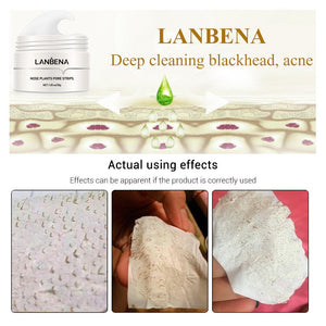 Blackhead Nasal Membrane Sucking Blackhead Tearing To Remove Acne - Zambeel