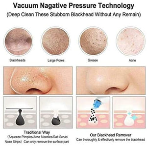 Blackhead Remover - Zambeel