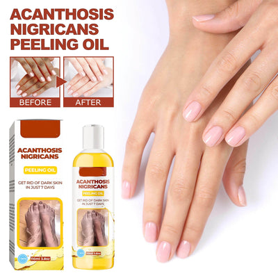Cleansing Moisturizing And Skincare Oil - Zambeel