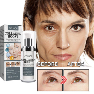 Collagen Anti Wrinkle Cream Tightens Skin - Zambeel