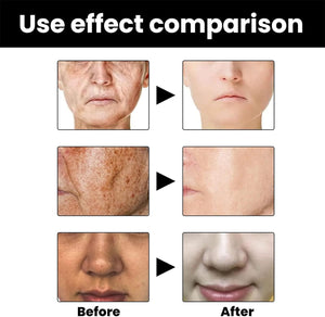 Eelhoe - Melanin Correcting Serum - Zambeel