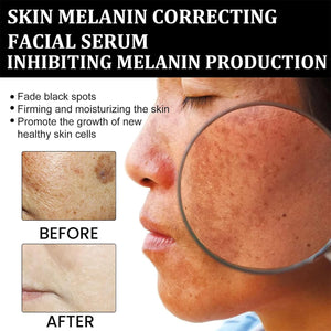 Eelhoe - Melanin Correcting Serum - Zambeel