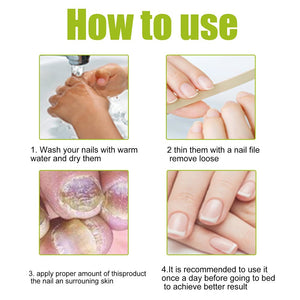 EELHOE - Nail Treatment Repair Gel - Zambeel