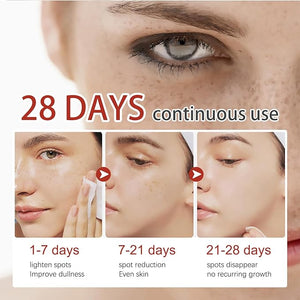 Eelhoe - Pigment Correcting Cream (Original) - Zambeel