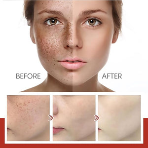 Eelhoe - Pigment Correcting Cream (Original) - Zambeel