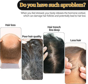 Eelhoe - Root Activation Shampoo (Original) - Zambeel