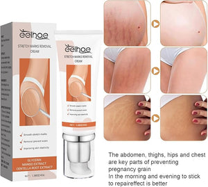 Eelhoe - Stretch Marks Removal Cream (Original) - Zambeel