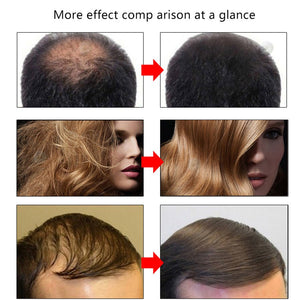Efero Hair Growth Fluid - Zambeel