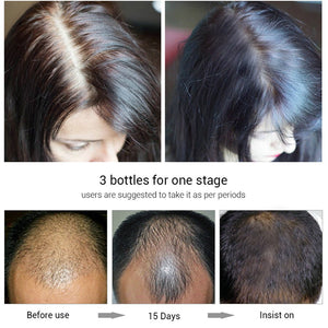 Efero Hair Growth Fluid - Zambeel