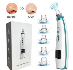 Electric Black Head Suction Instrument Face Cleaner - Zambeel