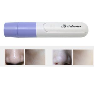 Electric Pore Cleanser Facial Massager - Zambeel