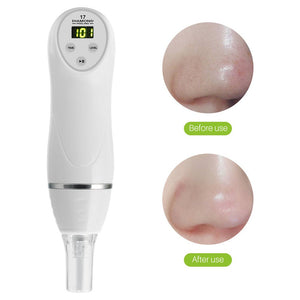Electric Pore Suction and Acne Removing Device Beauty Cleaner - Zambeel