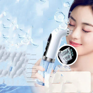 Electric Vacuum Blackhead Acne Pore Cleaner - Zambeel
