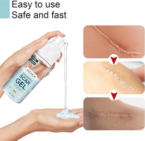 Elehoe - Advanced Scar Gel - Zambeel