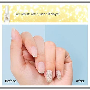 Eveline Cosmetics - 8 - in - 1 Nail Conditioner with Golden Particles (Original) - Zambeel