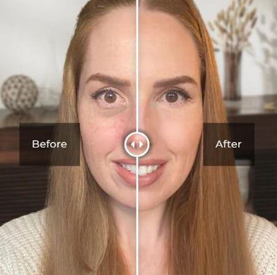 Eye Care Products - Zambeel
