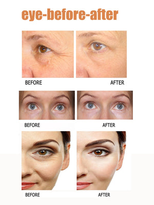 Eye Cream To Remove Eye Bags, Eye Cream , Eye Bag Care, Eye Care - Zambeel