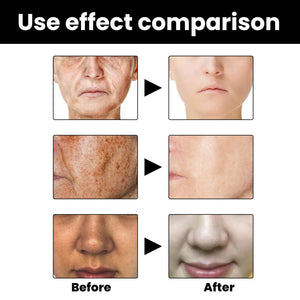 Facial Melanin Repair Hydrating Skincare Products - Zambeel