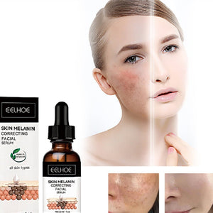 Facial Melanin Repair Hydrating Skincare Products - Zambeel