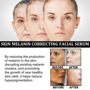 Facial Melanin Repair Hydrating Skincare Products - Zambeel