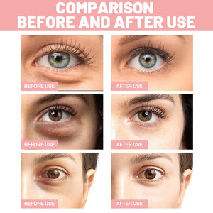 Fading Wrinkle Eye Bag Care - Zambeel