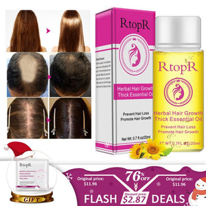 Fast Powerful Hair Growth Products Essential Oil Liquid Treatment Preventing Hair Loss Hair Care 20ml - Zambeel